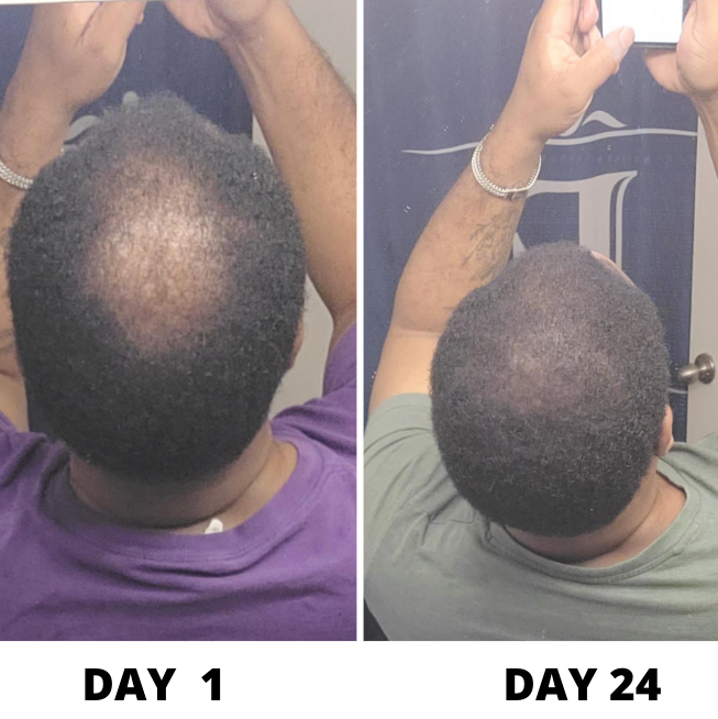 Hair Growth Serum-Say Goodbye To Hair Loss