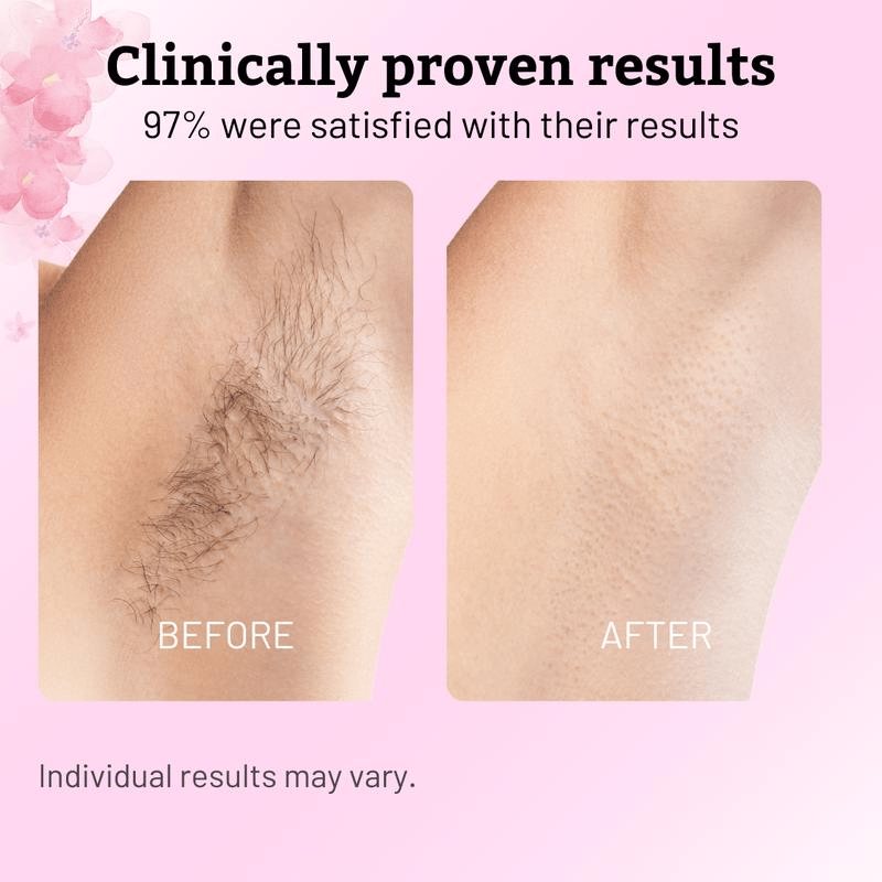✨ Caramela Beauty Cyperus Rotundus Oil for Natural Permanent Hair Reduction