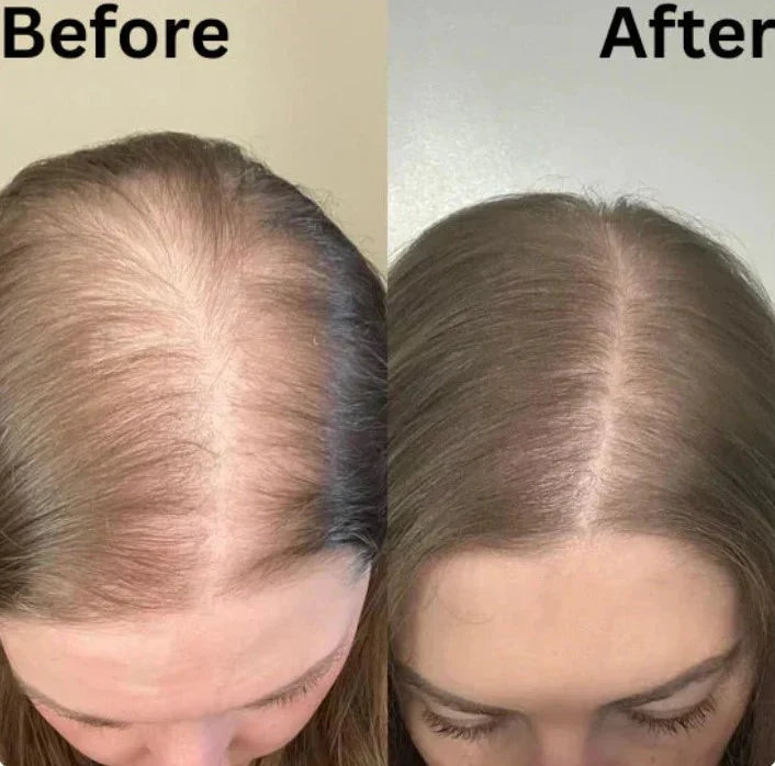 Rosemary Foaming Shampoo